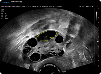 2D Follicle