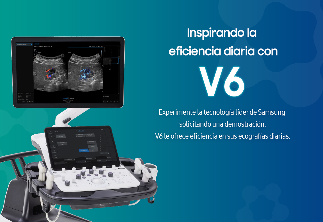 Inspirando la eficiencia diaria con V6 - V6 le ofrece eficiencia en sus ecografías diarias.