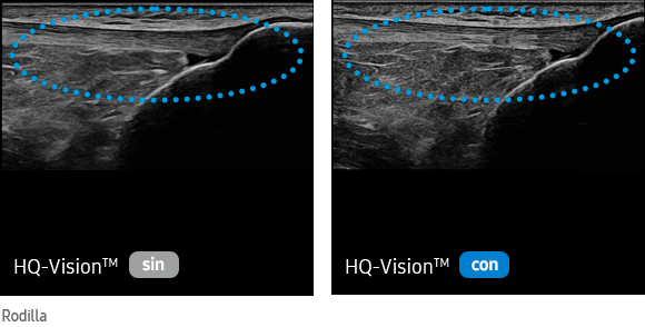 sin HQ-Vision™, con HQ-Vision™