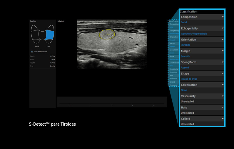 S-Detect™ para tiroides