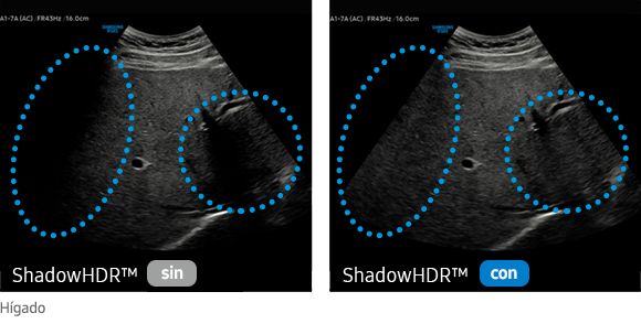 sin ShadowHDR™, con ShadowHDR™, Hígado