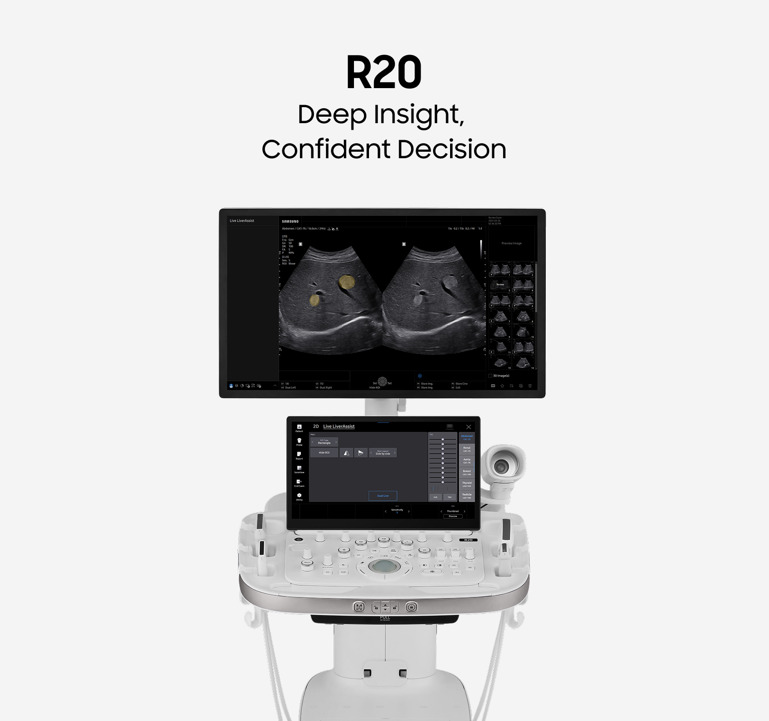 R20