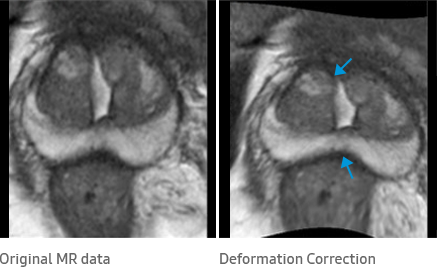 Original MR data, Deformation Correction