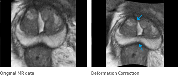 Original MR data, Deformation Correction