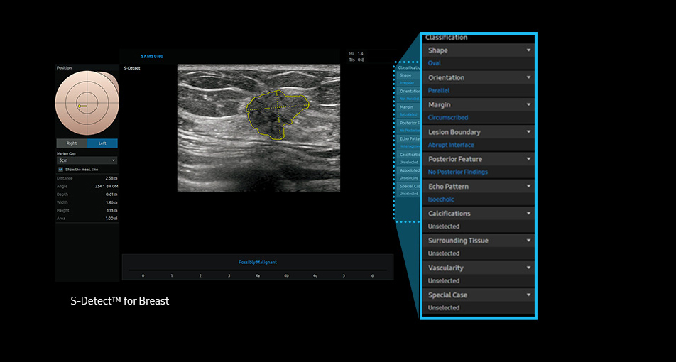 S-Detect™ for Breast