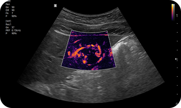 MV-Flow™ : Color imaging