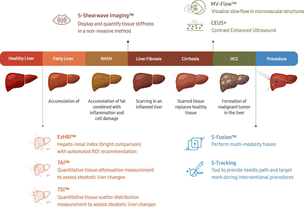 liver diagnosis Solutions