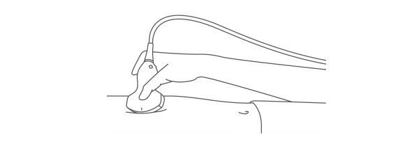 Positioning Auto using external marker for initial registration between CT/MR and ultrasound liver images