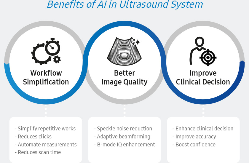 Benefits of AI in Ultrasound System