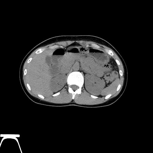 BodyTom-64-ABD-Non-Contrast-A-1