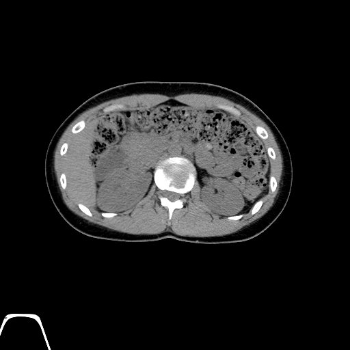 BodyTom-64-ABD-Non-Contrast-A-2