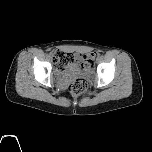 BodyTom-64-ABD-Non-Contrast-A-3