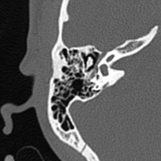 BodyTom-64-IAC-2