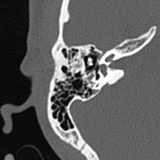 BodyTom-64-IAC-3