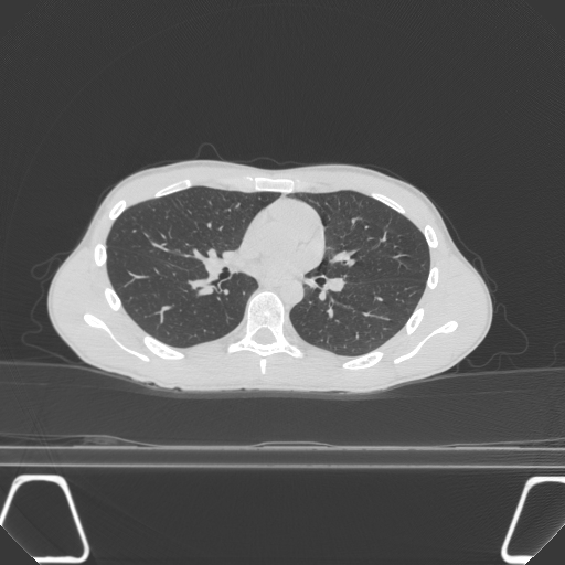 BodyTom-64-Lung-A-1