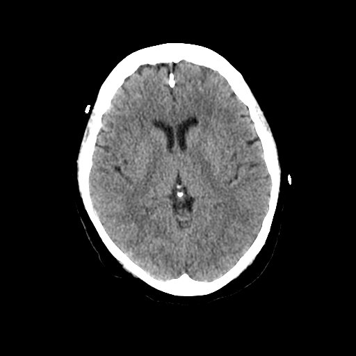 BodyTom-Brain-2