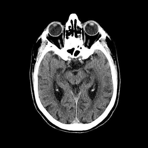 BodyTom-Brain-3