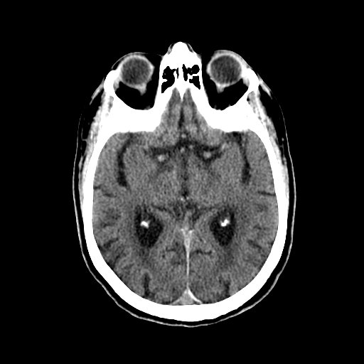 BodyTom-Brain-3b