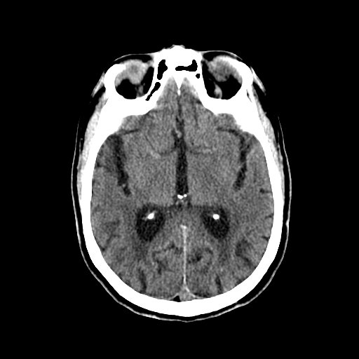 BodyTom-Brain-3c