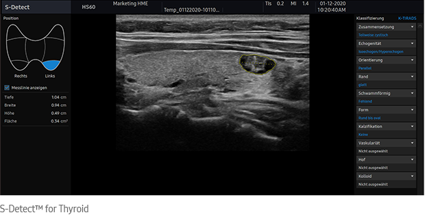 S-Detect™ for Thyroid