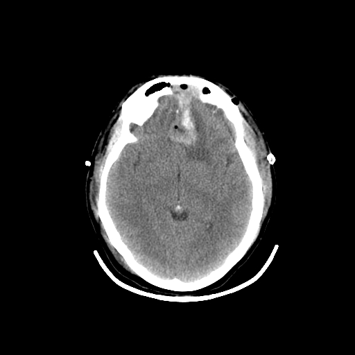 Adult-Brain-1