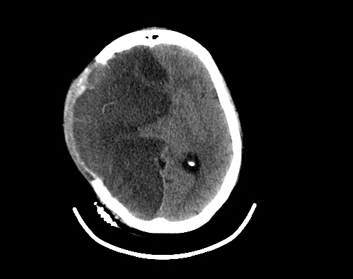 Axial-Brain