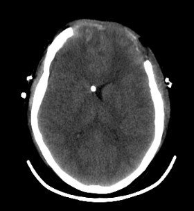 OmniTom-Adult-Brain