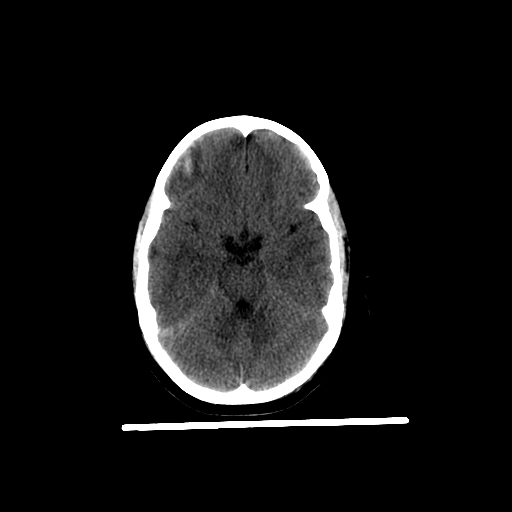 Axial-Brain-7-yo