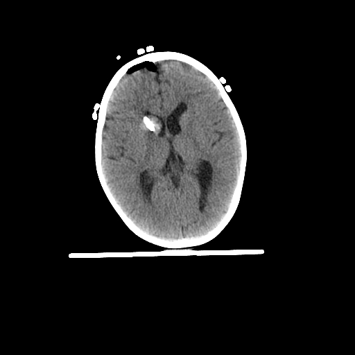Pediatric-4-yo-Brain