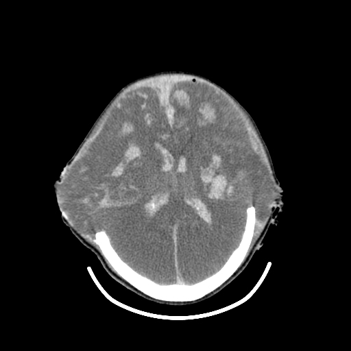 Pediatric-Brain