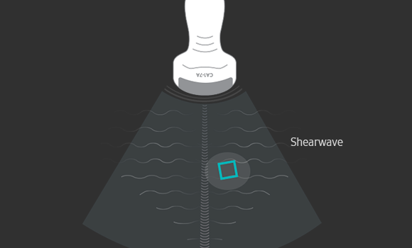 Shearwave