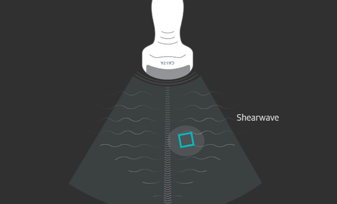 Shearwave
