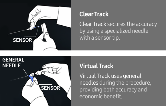 S-Tracking 