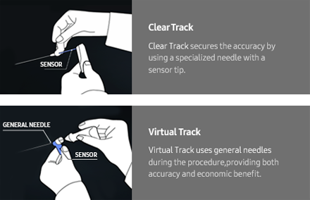 S-Tracking 