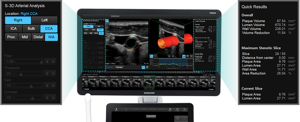 S-3D Arterial Analysis™ 