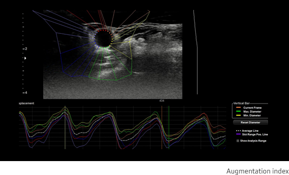 Arterial Analysis™