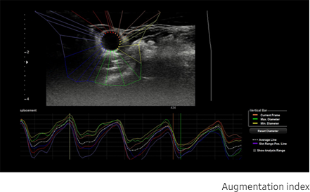 Arterial Analysis™