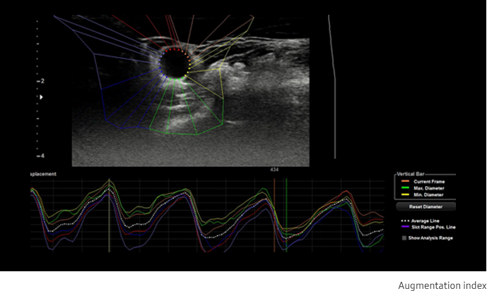 Arterial Analysis™