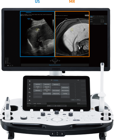 medical devices RS85 Prestige 