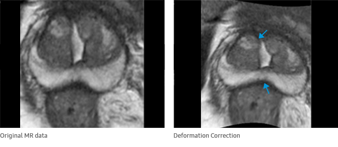 Original MR data, Deformation Correction