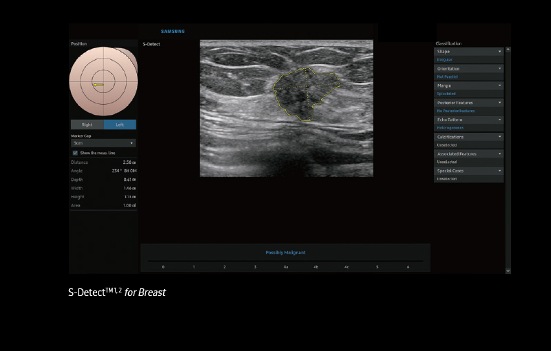 S-Detect™ ¹ for Breast