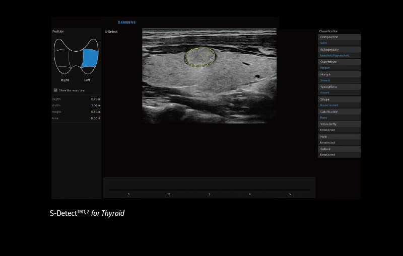 S-Detect™ ¹ for Thyroid