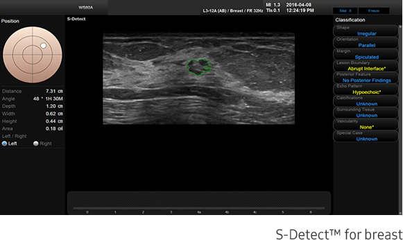 Cervix stiffness measurement with E-Cervix™