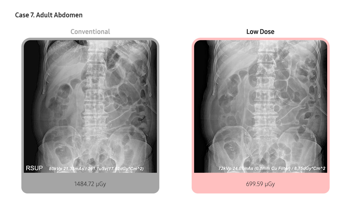 Case 7. Adult Abdomen