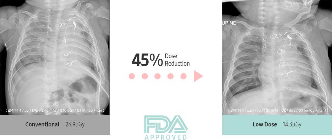 45% Dose Reduction