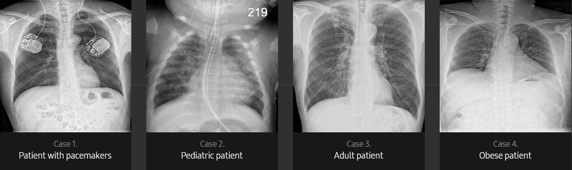 Chest Sample