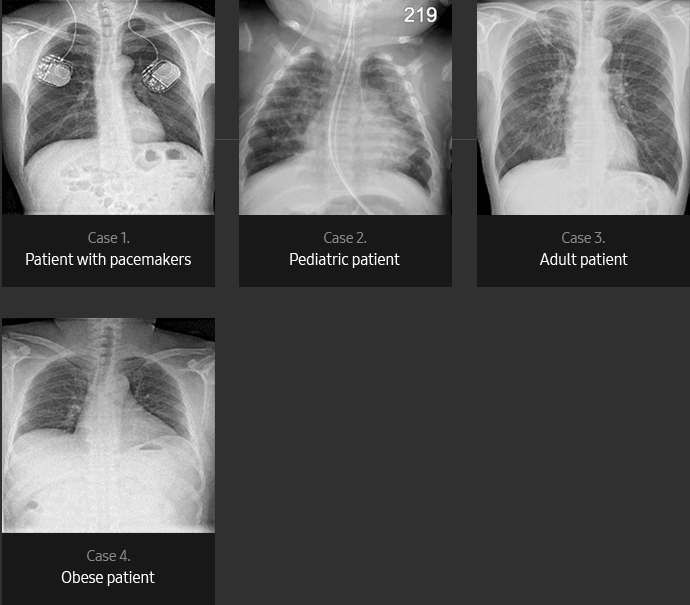 Chest Sample