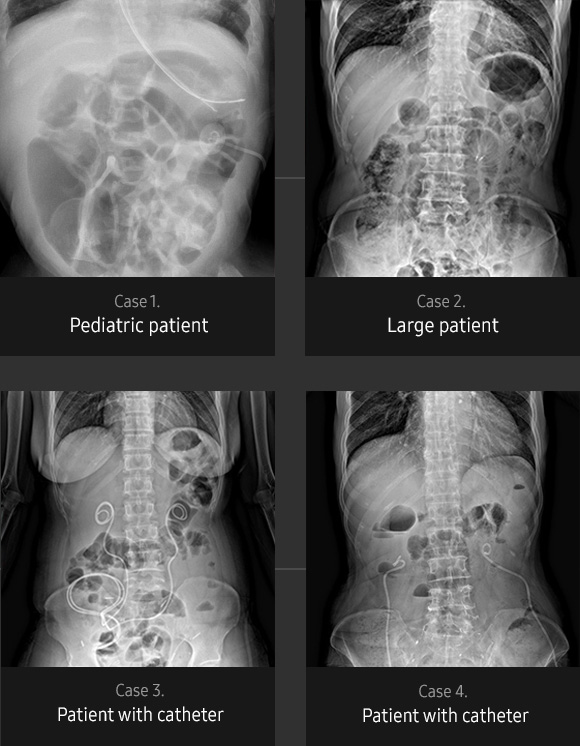 Abdomen Sample