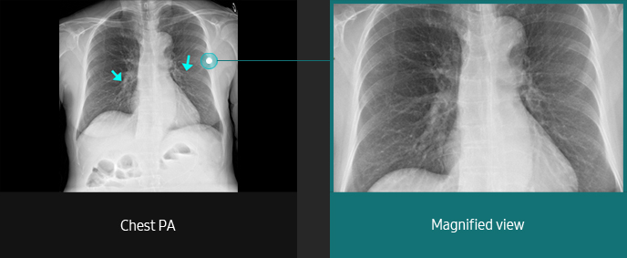 Chest Sample