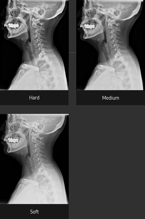 Cervical spine lateralSample